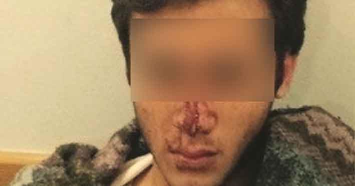 Case Of Beating Involving Turkish Teenager Two Teenagers To Be Charge