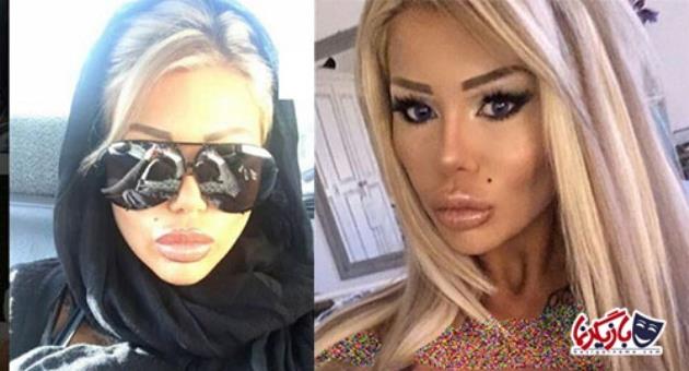 Porn star risks death sentence by going to Iran for nose job ...