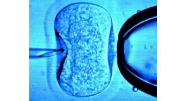 Minister appoints new members to Embryo Protection Authority - The ...